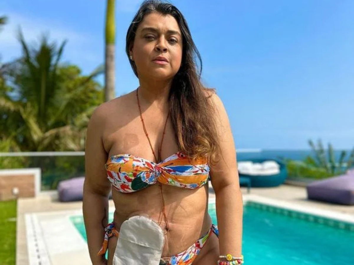 Usando bolsa de colostomia permanente, como será a vida de Preta Gil? Médico responde Usando bolsa de colostomia permanente, como será a vida de Preta Gil? Médico responde